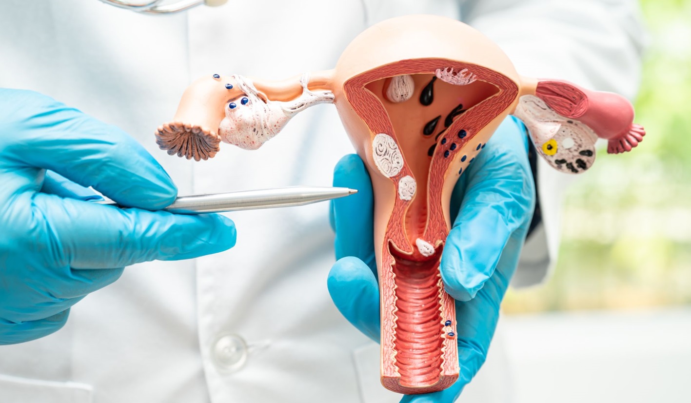 Prefeitura de Lages  Unidade Básica de Saúde do bairro Santa Catarina amplifica acesso ao exame preventivo ao câncer do colo do útero para moradoras de três áreas