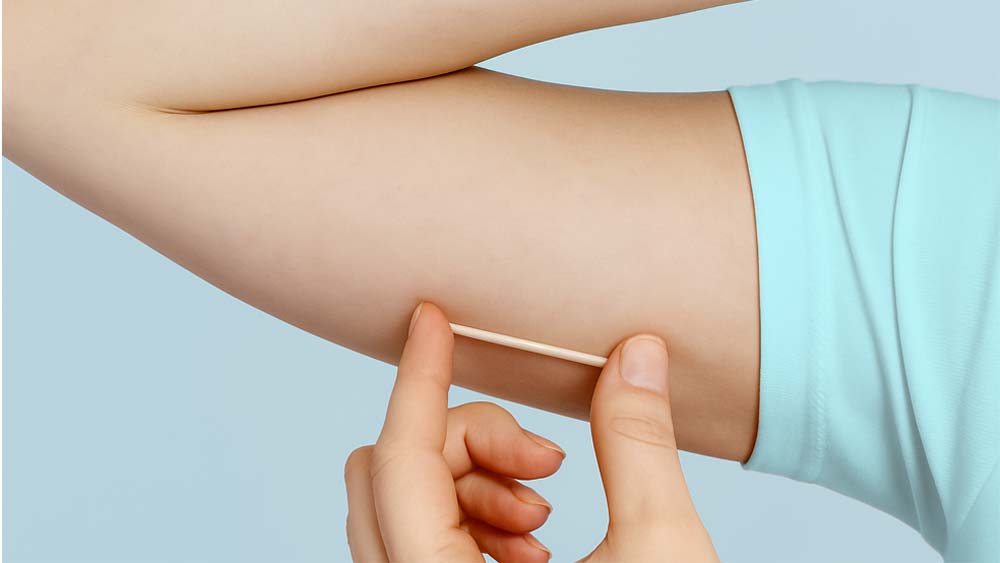 Prefeitura de Lages Prefeitura de Lages passa a ofertar novo método contraceptivo subdérmico na rede municipal de saúde 