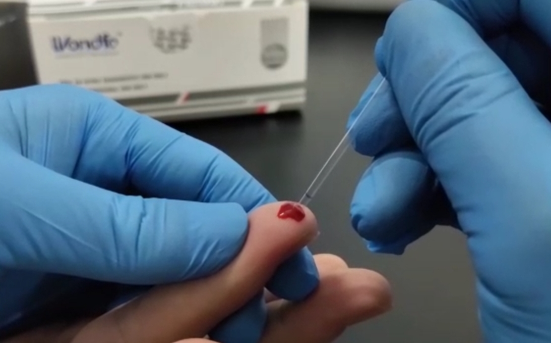 Prefeitura de Lages Prefeitura constitui estratégia de testes rápidos para novo Coronavírus e procedimentos devem iniciar em 1º de junho 