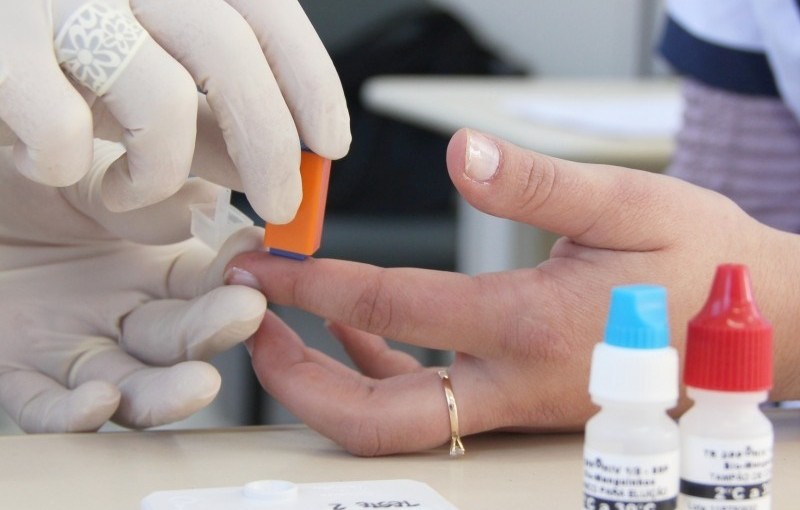 Prefeitura de Lages Dezembro Vermelho: Outra pandemia assusta e leva vidas embora há quase quatro décadas, a Aids 